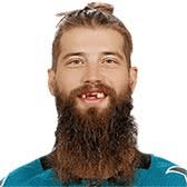 burns
